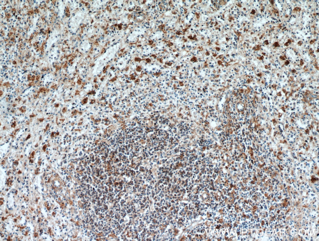 IHC staining of human spleen using 20825-1-AP