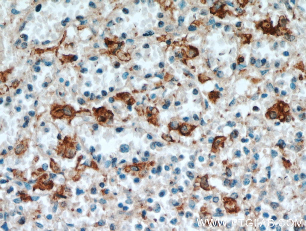 Immunohistochemistry (IHC) staining of human spleen tissue using SGSM3 Polyclonal antibody (20825-1-AP)