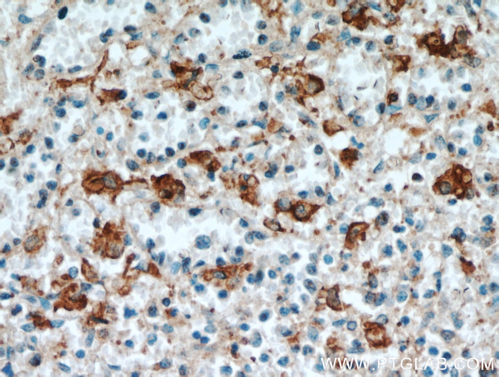 IHC staining of human spleen using 20825-1-AP