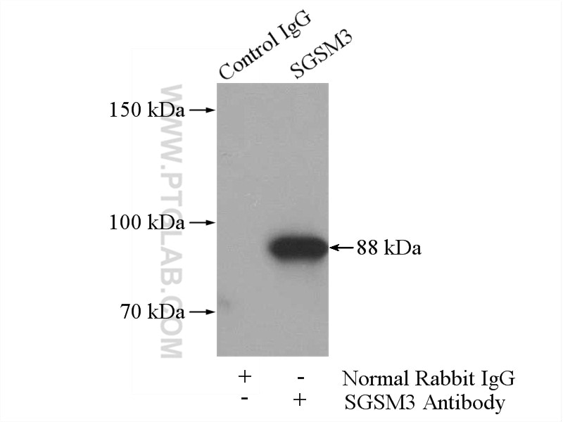 Immunoprecipitation (IP) experiment of mouse brain tissue using SGSM3 Polyclonal antibody (20825-1-AP)