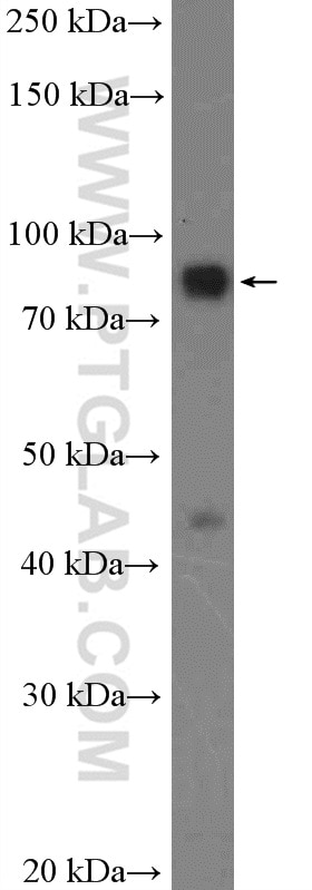 Western Blot (WB) analysis of fetal human brain tissue using SGSM3 Polyclonal antibody (20825-1-AP)