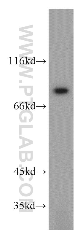 Western Blot (WB) analysis of mouse brain tissue using SGSM3 Polyclonal antibody (20825-1-AP)