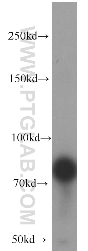 Western Blot (WB) analysis of mouse testis tissue using SGSM3 Polyclonal antibody (20825-1-AP)