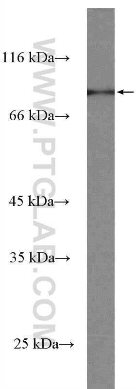 WB analysis of mouse brain using 27147-1-AP