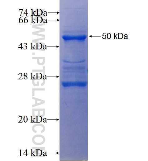 SGSM3 fusion protein Ag25954 SDS-PAGE