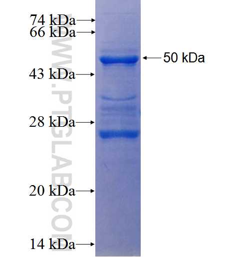 SGSM3 fusion protein Ag25954 SDS-PAGE