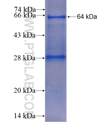 SGSM3 fusion protein Ag14800 SDS-PAGE