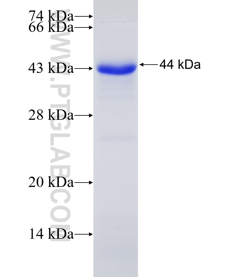 SGSM3 fusion protein Ag15416 SDS-PAGE