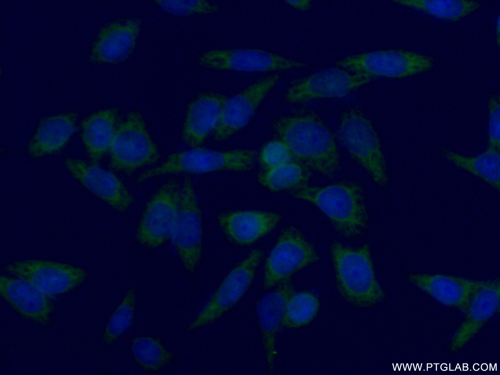 Immunofluorescence (IF) / fluorescent staining of HeLa cells using SGTA Polyclonal antibody (11019-2-AP)