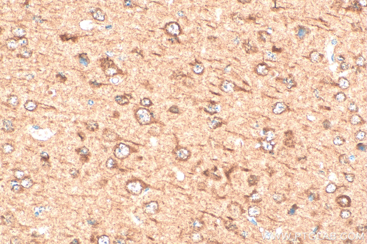 Immunohistochemistry (IHC) staining of mouse brain tissue using SGTA Polyclonal antibody (11019-2-AP)