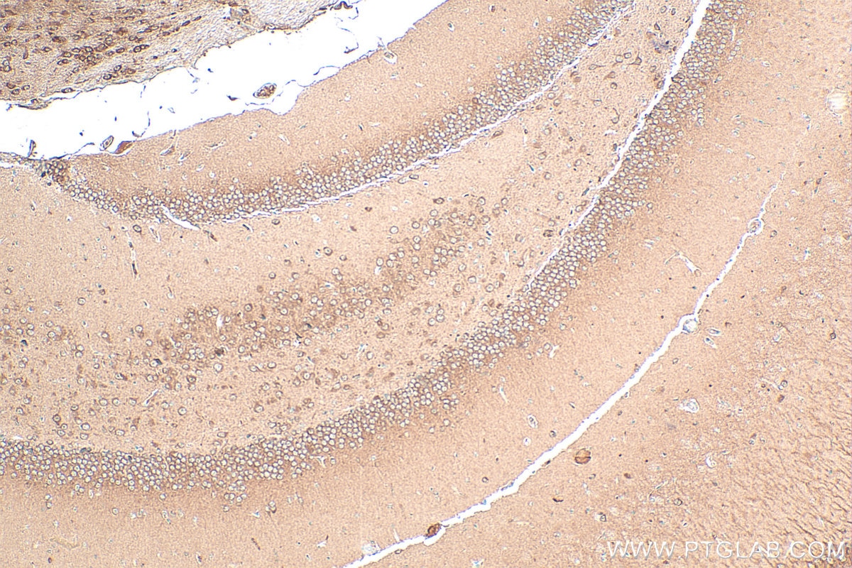 Immunohistochemistry (IHC) staining of mouse brain tissue using SGTA Polyclonal antibody (11019-2-AP)
