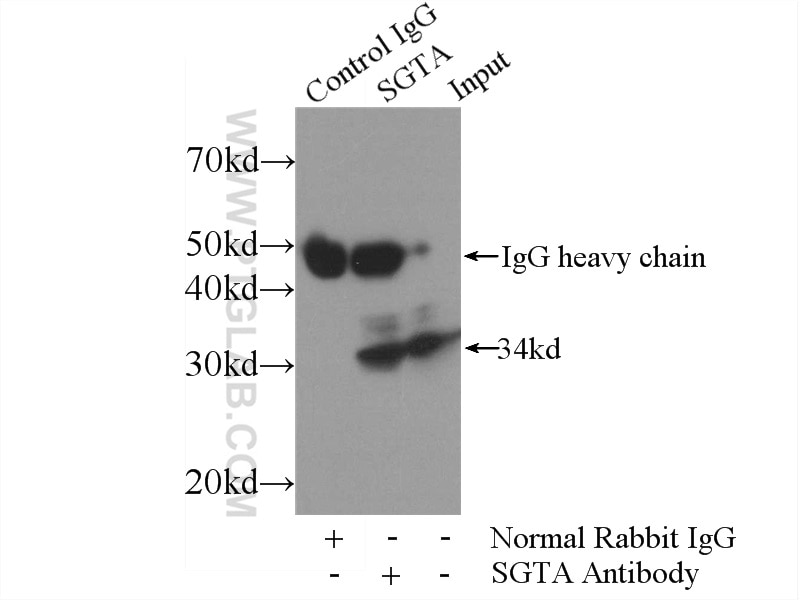 Immunoprecipitation (IP) experiment of HeLa cells using SGTA Polyclonal antibody (11019-2-AP)