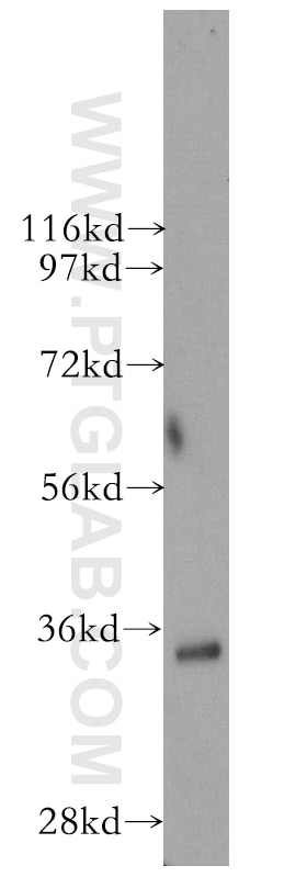 Western Blot (WB) analysis of human skeletal muscle tissue using SGTA Polyclonal antibody (11019-2-AP)