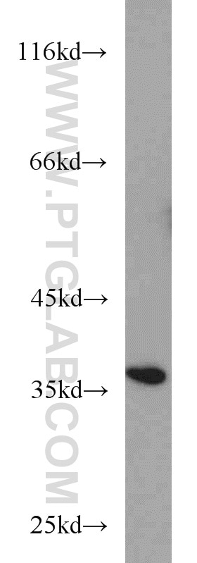Western Blot (WB) analysis of HeLa cells using SGTA Polyclonal antibody (11019-2-AP)
