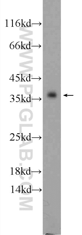 Western Blot (WB) analysis of mouse liver tissue using SGTA Polyclonal antibody (11019-2-AP)