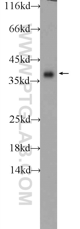 Western Blot (WB) analysis of SH-SY5Y cells using SGTA Polyclonal antibody (11019-2-AP)