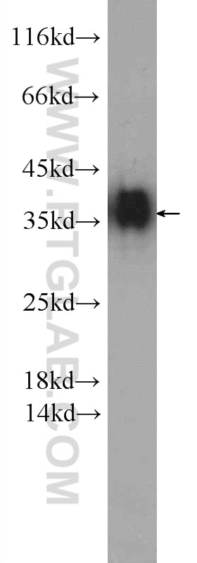 Western Blot (WB) analysis of K-562 cells using SGTA Polyclonal antibody (11019-2-AP)