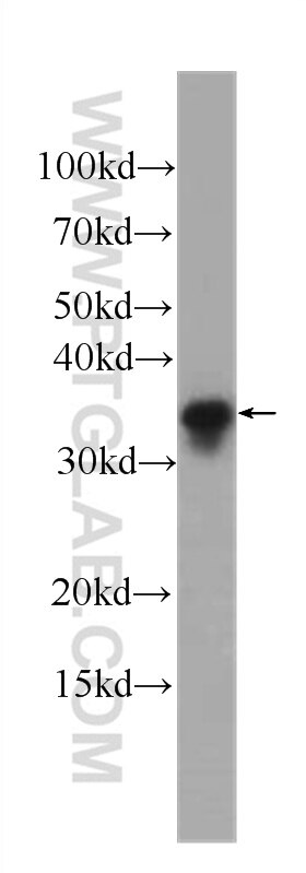 Western Blot (WB) analysis of fetal human brain tissue using SGTA Monoclonal antibody (60305-1-Ig)