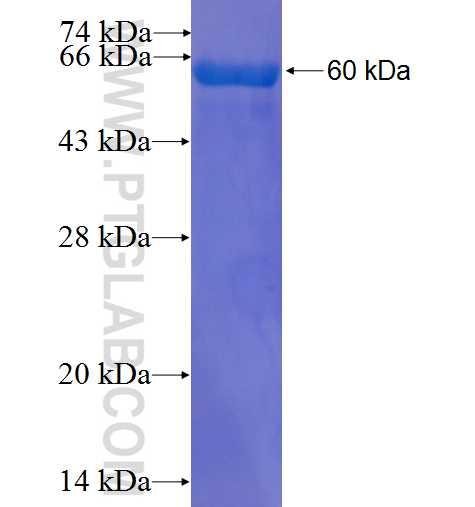SGTA fusion protein Ag1475 SDS-PAGE