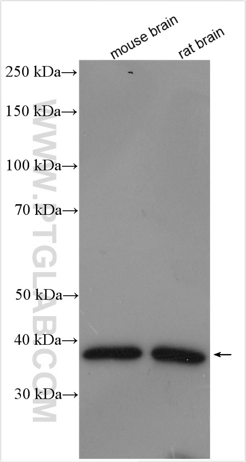 Western Blot (WB) analysis of various lysates using SGTB Polyclonal antibody (15895-1-AP)