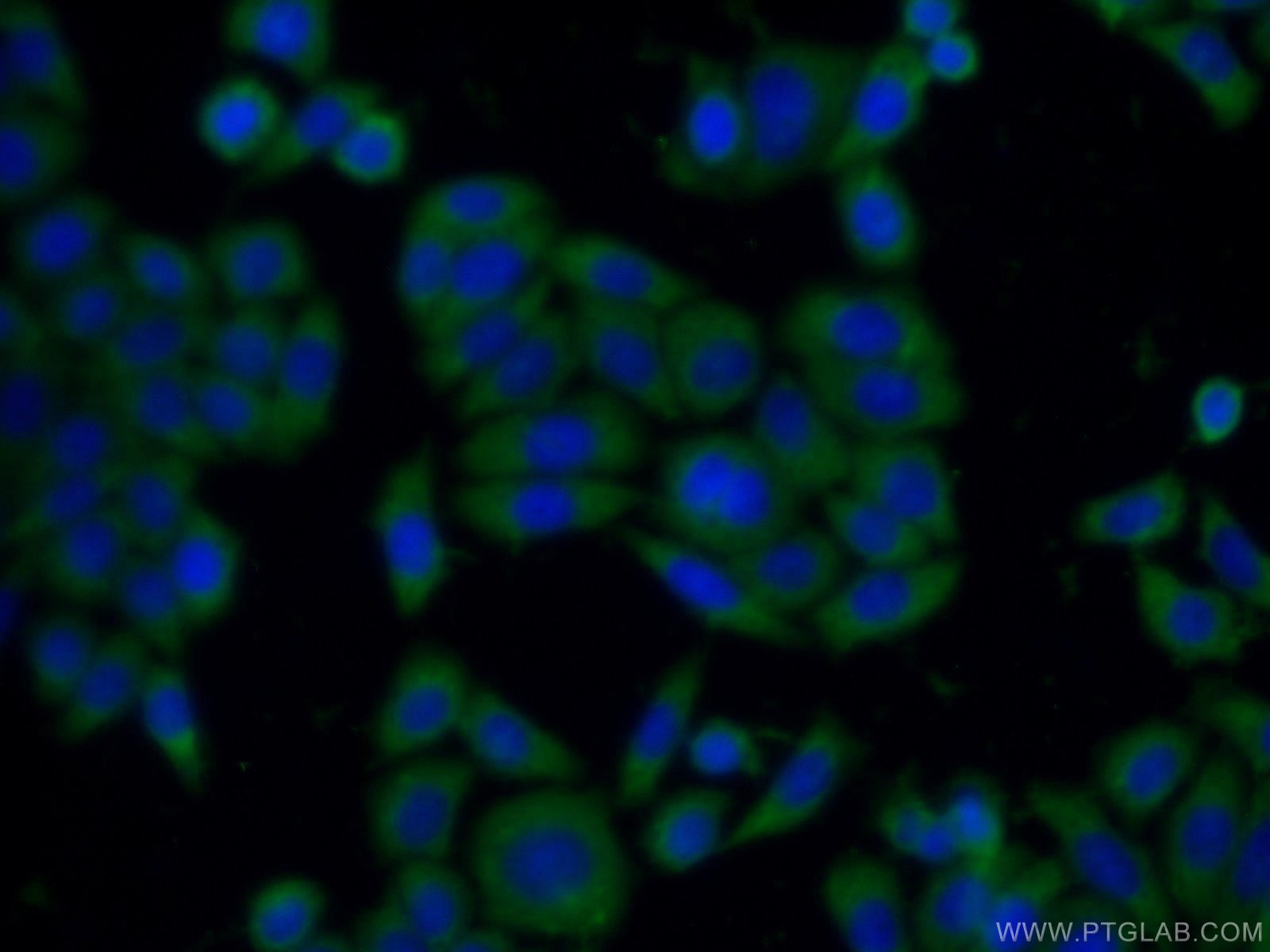 Immunofluorescence (IF) / fluorescent staining of HeLa cells using SH2B1 Polyclonal antibody (12226-1-AP)