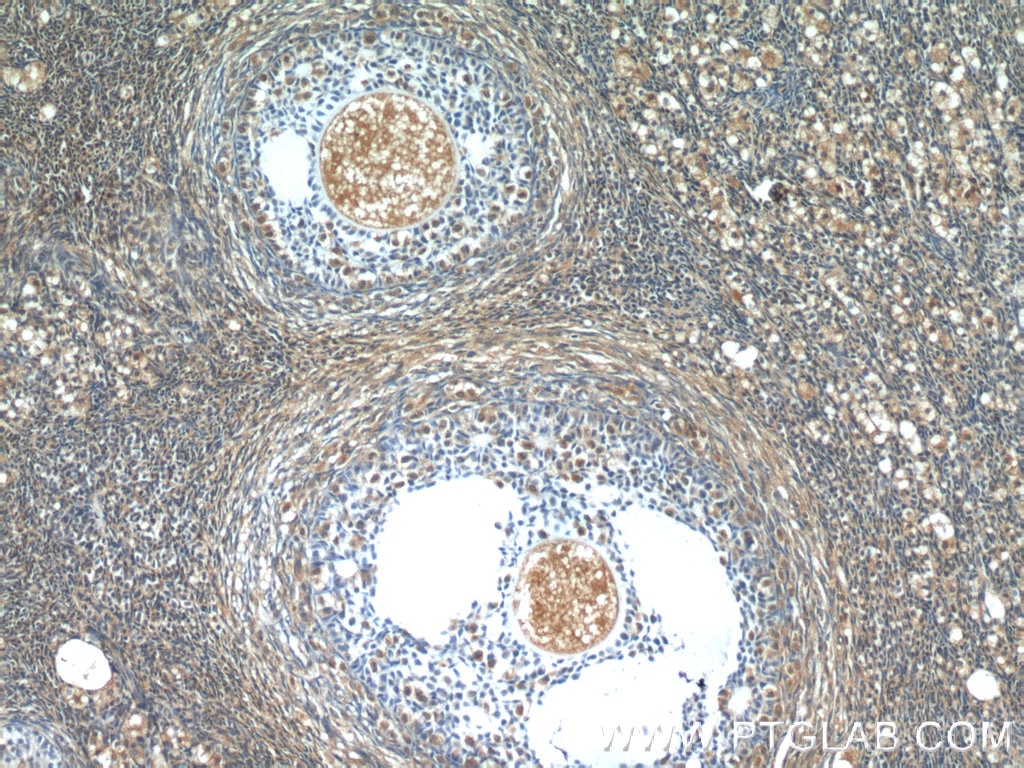 Immunohistochemistry (IHC) staining of human ovary tissue using SH2B1 Polyclonal antibody (12226-1-AP)