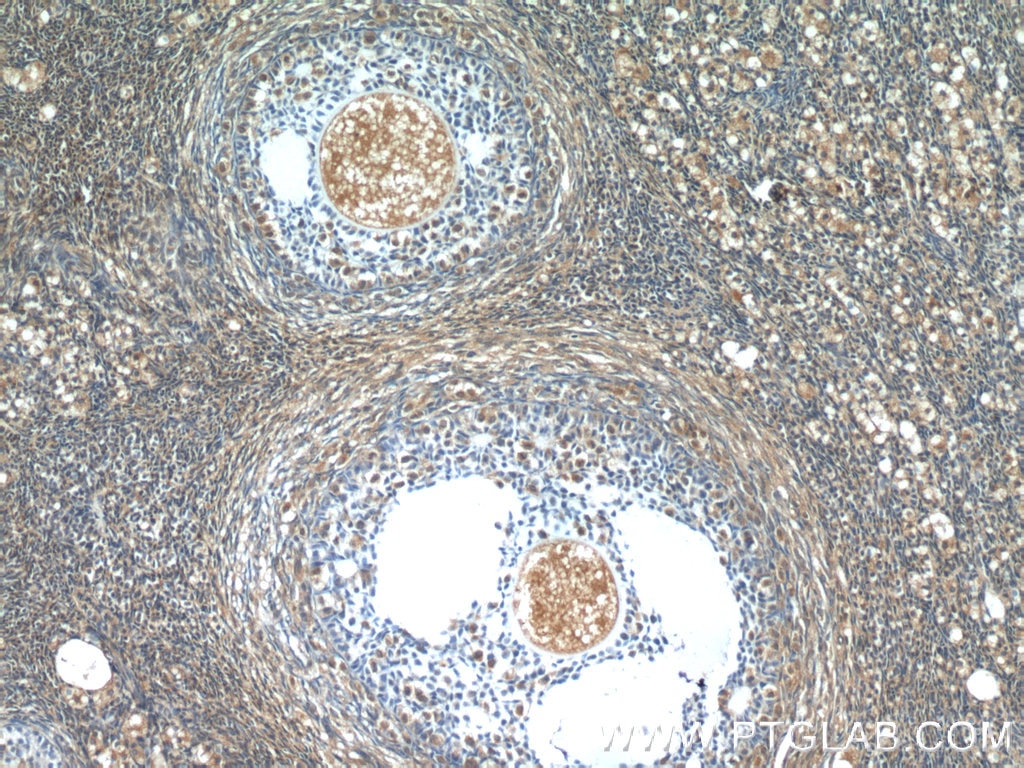 IHC staining of human ovary using 12226-1-AP