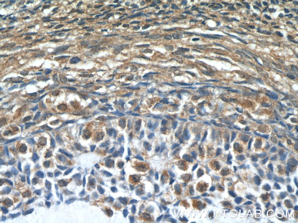 Immunohistochemistry (IHC) staining of human ovary tissue using SH2B1 Polyclonal antibody (12226-1-AP)