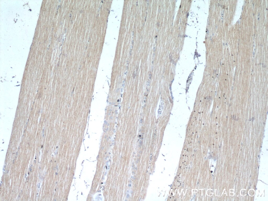 IHC staining of human skeletal muscle using 12226-1-AP