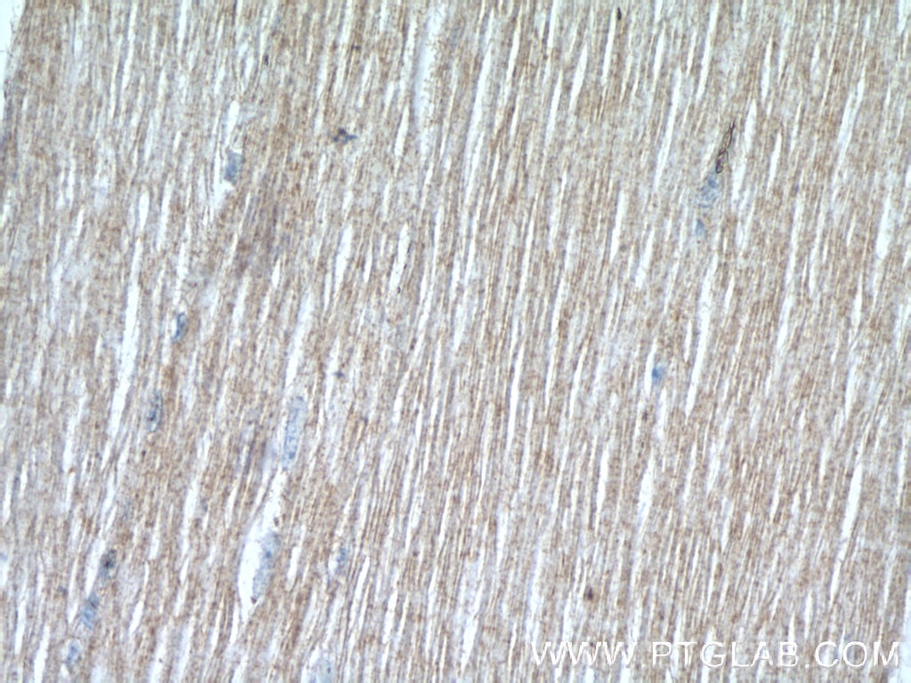 Immunohistochemistry (IHC) staining of human skeletal muscle tissue using SH2B1 Polyclonal antibody (12226-1-AP)