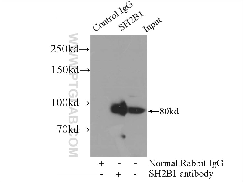 Immunoprecipitation (IP) experiment of HEK-293 cells using SH2B1 Polyclonal antibody (12226-1-AP)