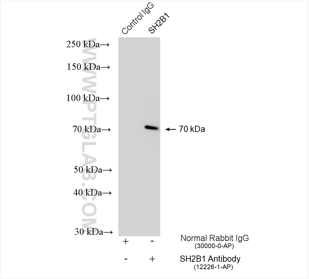 IP experiment of HepG2 using 12226-1-AP Immunoprecipitation (IP) experiment of HepG2 cells using SH2B1 Polyclonal antibody (12226-1-AP)