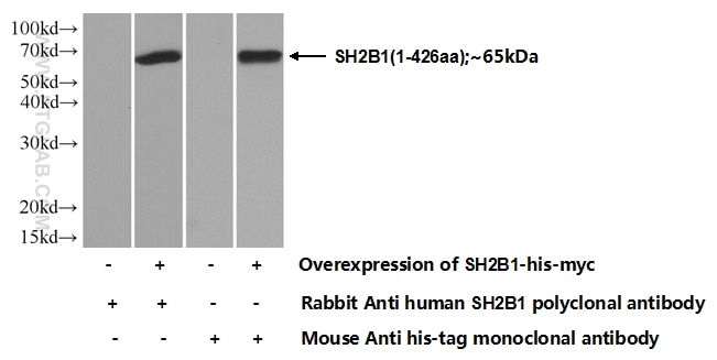 SH2B1 Polyclonal antibody