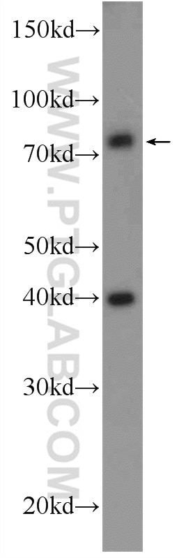 Western Blot (WB) analysis of HEK-293 cells using SH2B1 Polyclonal antibody (12226-1-AP)