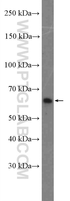 Western Blot (WB) analysis of HEK-293T cells using SH2B3 Polyclonal antibody (22198-1-AP)