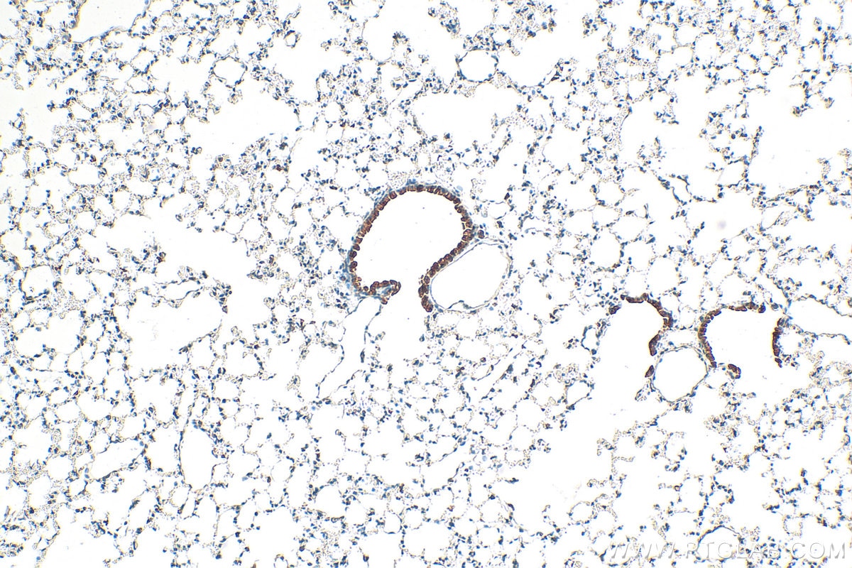 Immunohistochemistry (IHC) staining of mouse lung tissue using SH2D1A Polyclonal antibody (11868-1-AP)