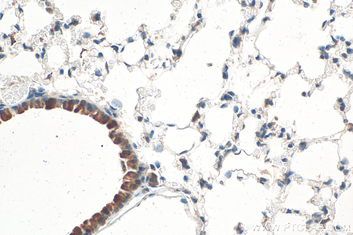 Immunohistochemistry (IHC) staining of mouse lung tissue using SH2D1A Polyclonal antibody (11868-1-AP)