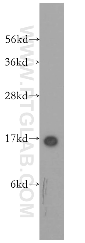 WB analysis of mouse thymus using 11868-1-AP