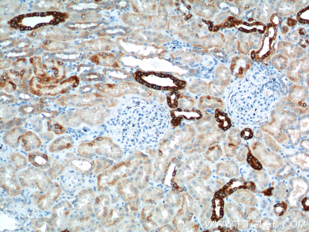 Immunohistochemistry (IHC) staining of human kidney tissue using SH2D1B Polyclonal antibody (11871-1-AP)