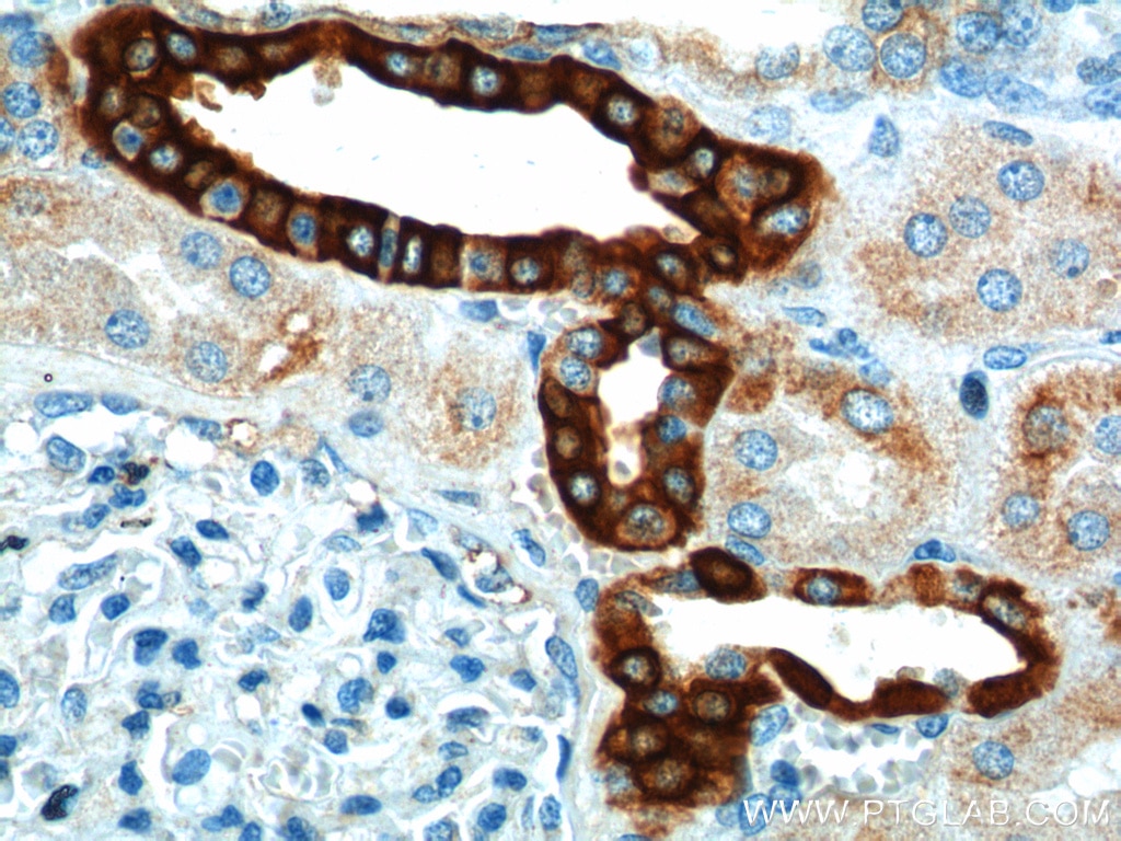 Immunohistochemistry (IHC) staining of human kidney tissue using SH2D1B Polyclonal antibody (11871-1-AP)