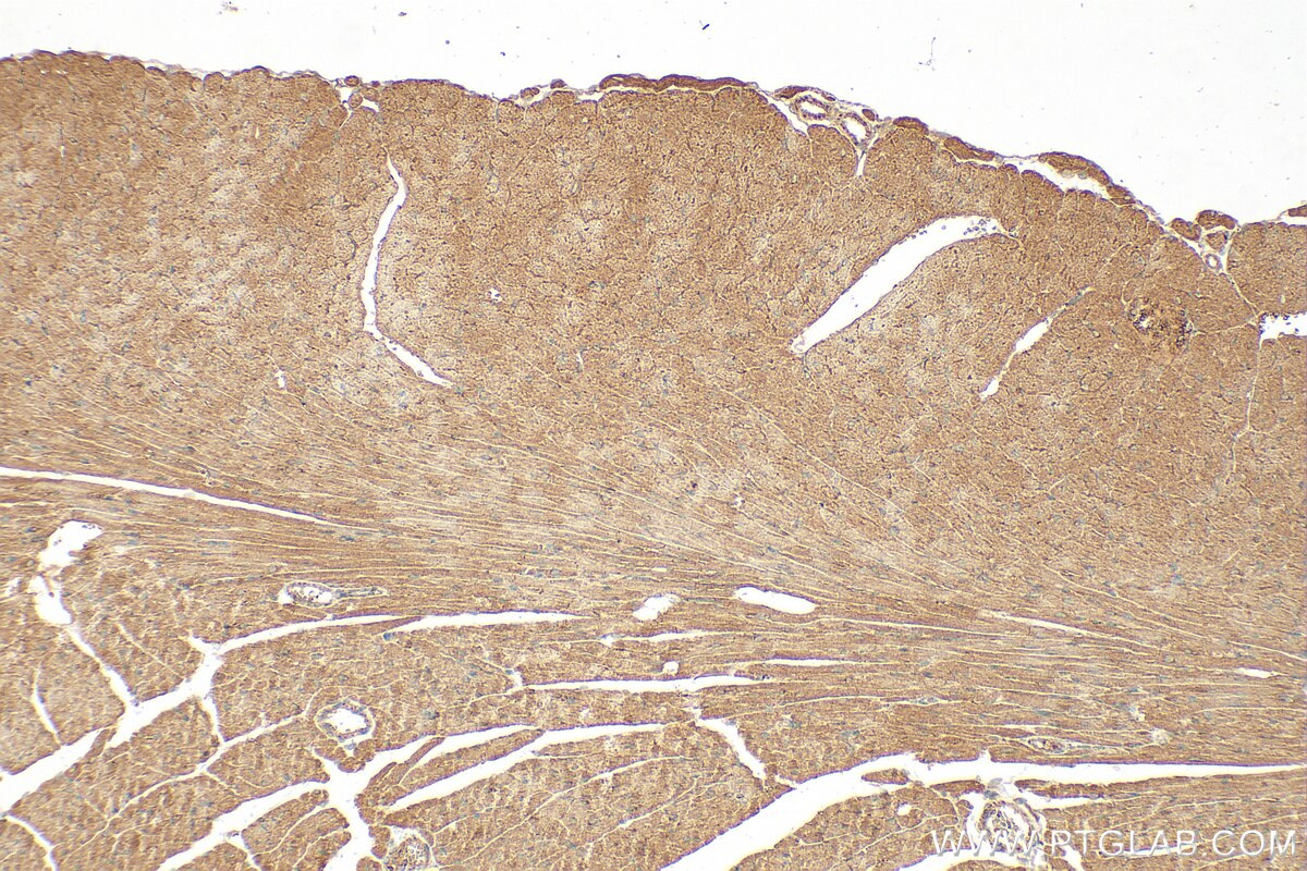 Immunohistochemistry (IHC) staining of mouse heart tissue using SH2D2A Polyclonal antibody (18539-1-AP)