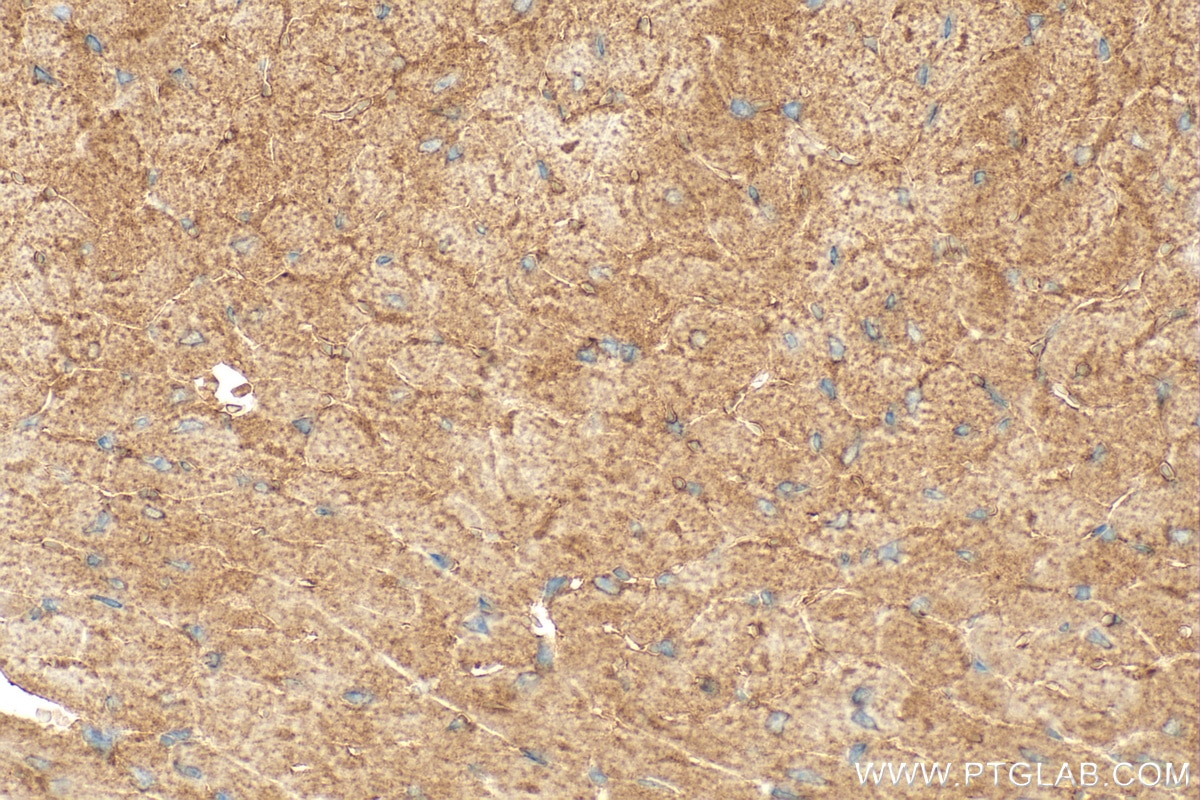 Immunohistochemistry (IHC) staining of mouse heart tissue using SH2D2A Polyclonal antibody (18539-1-AP)
