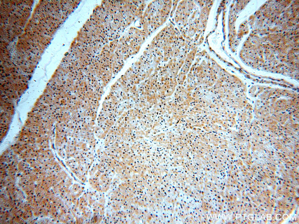 Immunohistochemistry (IHC) staining of human heart tissue using SH2D2A Polyclonal antibody (18539-1-AP)