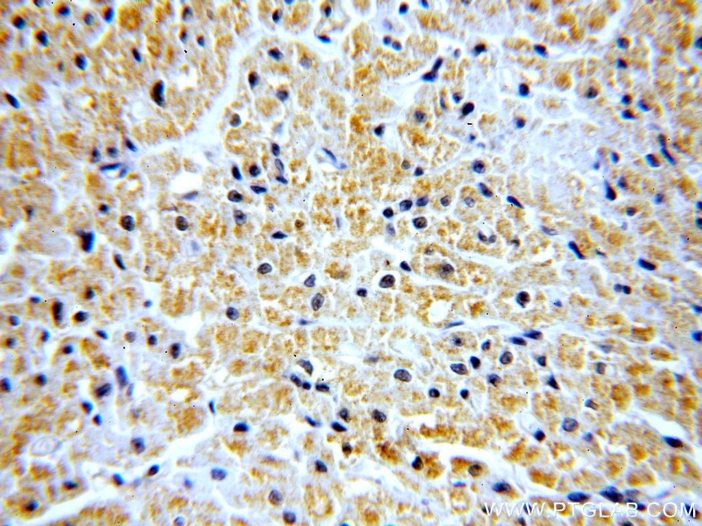 IHC staining of human heart using 18539-1-AP