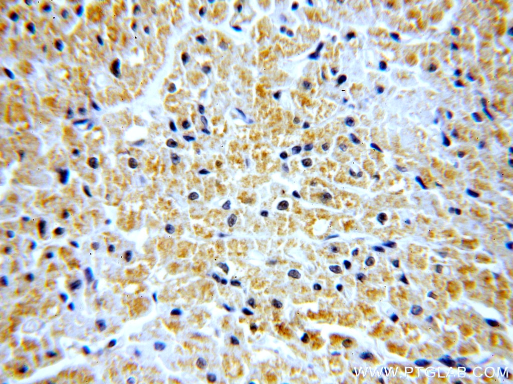 Immunohistochemistry (IHC) staining of human heart tissue using SH2D2A Polyclonal antibody (18539-1-AP)