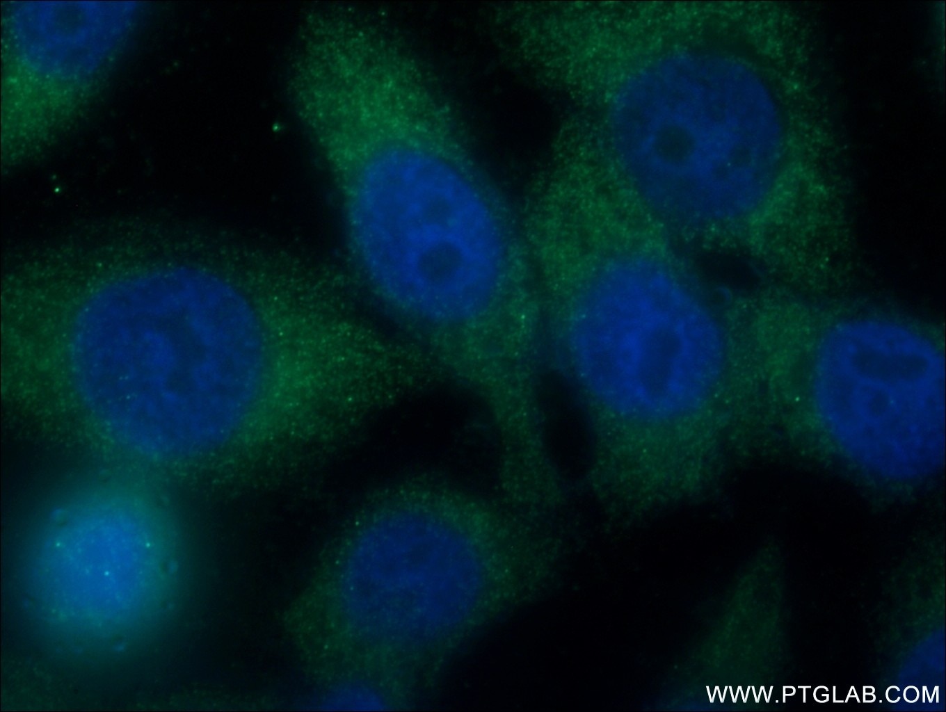 Immunofluorescence (IF) / fluorescent staining of HeLa cells using SH2D3A Polyclonal antibody (15641-1-AP)