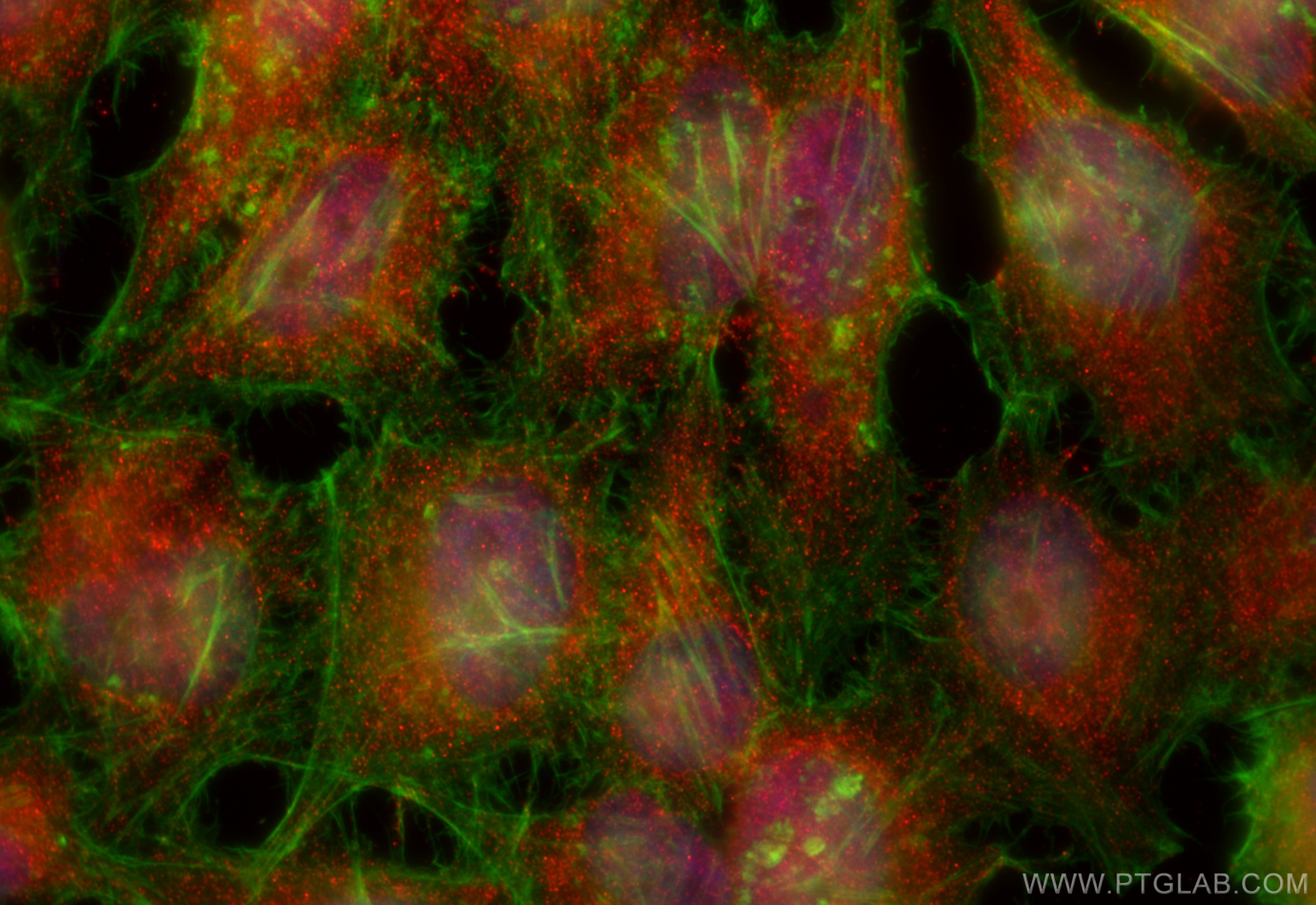 Immunofluorescence (IF) / fluorescent staining of HeLa cells using SH2D3A Polyclonal antibody (15641-1-AP)