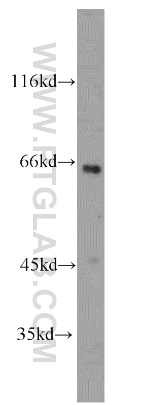 Western Blot (WB) analysis of HeLa cells using SH2D3A Polyclonal antibody (15641-1-AP)