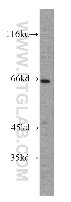 Western Blot (WB) analysis of HepG2 cells using SH2D3A Polyclonal antibody (15641-1-AP)