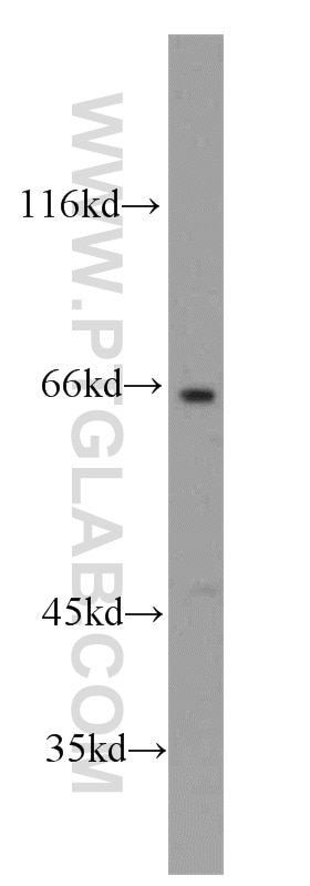 Western Blot (WB) analysis of HEK-293 cells using SH2D3A Polyclonal antibody (15641-1-AP)